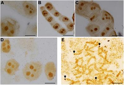 Structure and Methylation of 35S rDNA in Allopolyploids Anemone multifida (2n = 4x = 32, BBDD) and Anemone baldensis (2n = 6x = 48, AABBDD) and Their Parental Species Show Evidence of Nucleolar Dominance